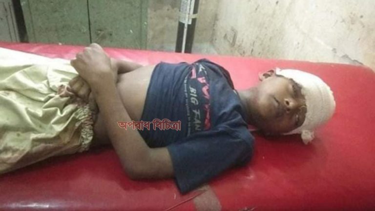 গাছ থেকে পড়ে মৃত্যু শয্যায় এতিম মাদরাসাছাত্র বাঁচতে- চায় সহায়তা
