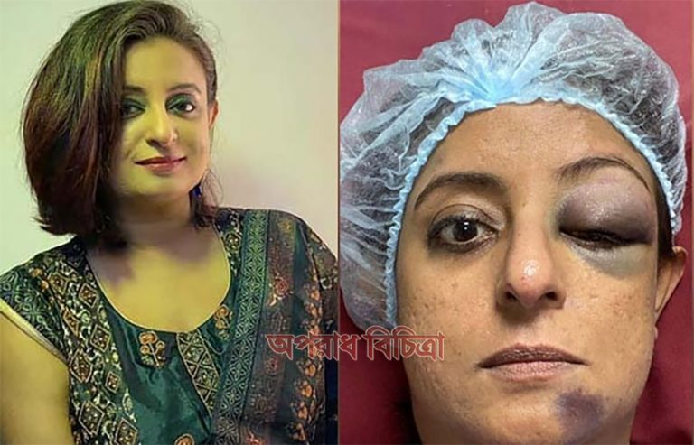 উন্নত চিকিৎসার জন্য ভারতে গিয়ে গুরুতর আহত সংগীতশিল্পী……. আলিফ