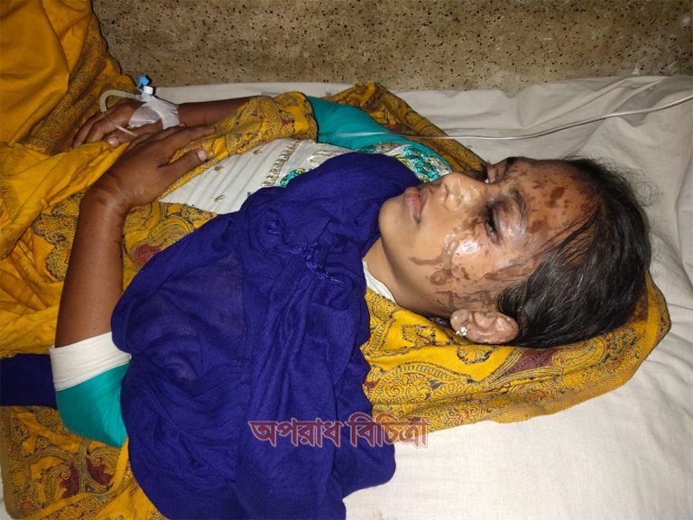 পটুয়াখালীতে গৃহবধুর মুখে এসিড নিক্ষেপ