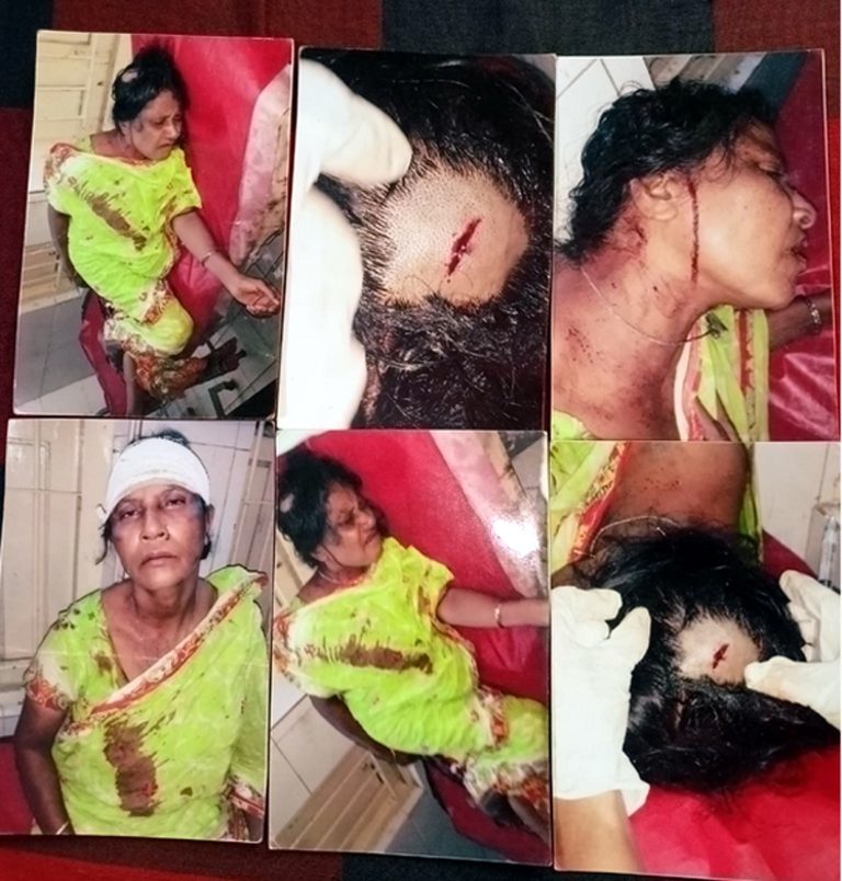 চট্টগ্রামে জমি দখলে নিতে মা-মেয়েকে কুপিয়ে হত্যার চেষ্টা