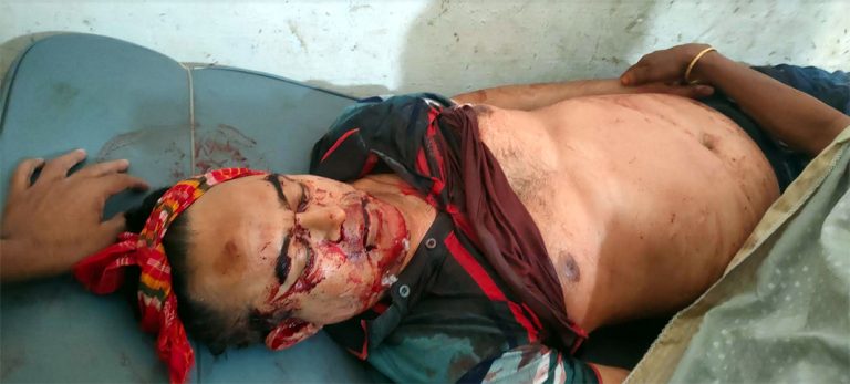 শার্শায় দ্রুতগামী মটরসাইকেলের ধাক্কায় এ্যাডভোকেট নিহত