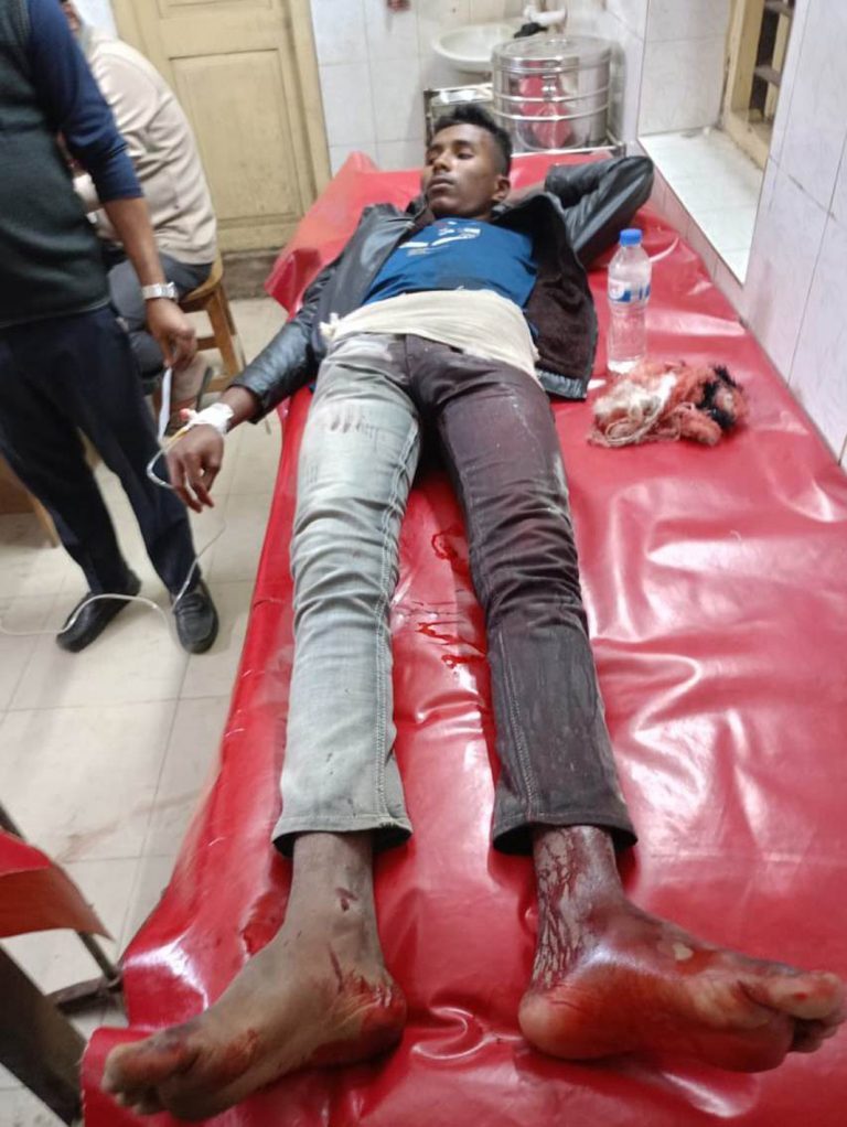 দেবীদ্বারে মাহফিলে লটারীতে সিদ্ধ ডিম কেনা দ্বন্দ্বের জের ছুরিকাঘাতে আহত-০১